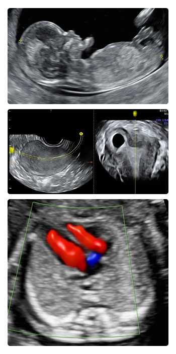 ISUOG Obstetric Ultrasound Workshop CUSP 2026 Chennai fetal imaging session
