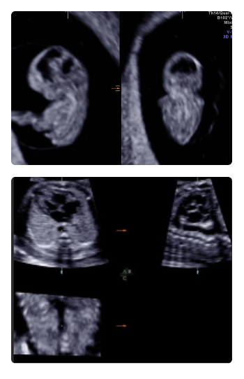 3D 4D ultrasound workshop Chennai 2026 fetal imaging training STIC cardiac ultrasound